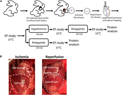 Beneficial Electrophysiological Effects of Rotigaptide Are Unable to Suppress Therapeutic Hypothermia-Provoked Ventricular Fibrillation in Failing Rabbit Hearts With Acute Ischemia–Reperfusion Injury